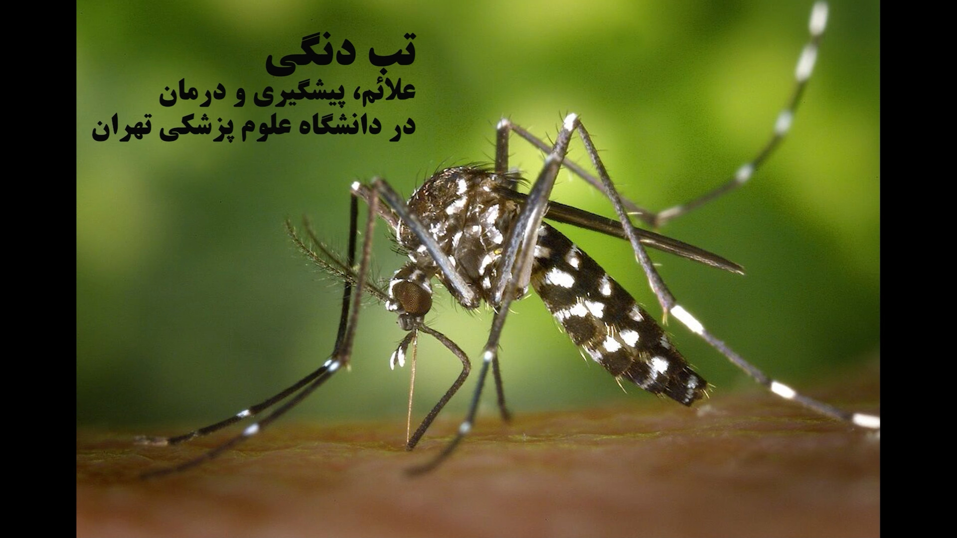 تب دنگی علائم، پیشگیری و درمان در دانشگاه علوم پزشکی تهران ترمیم دندان