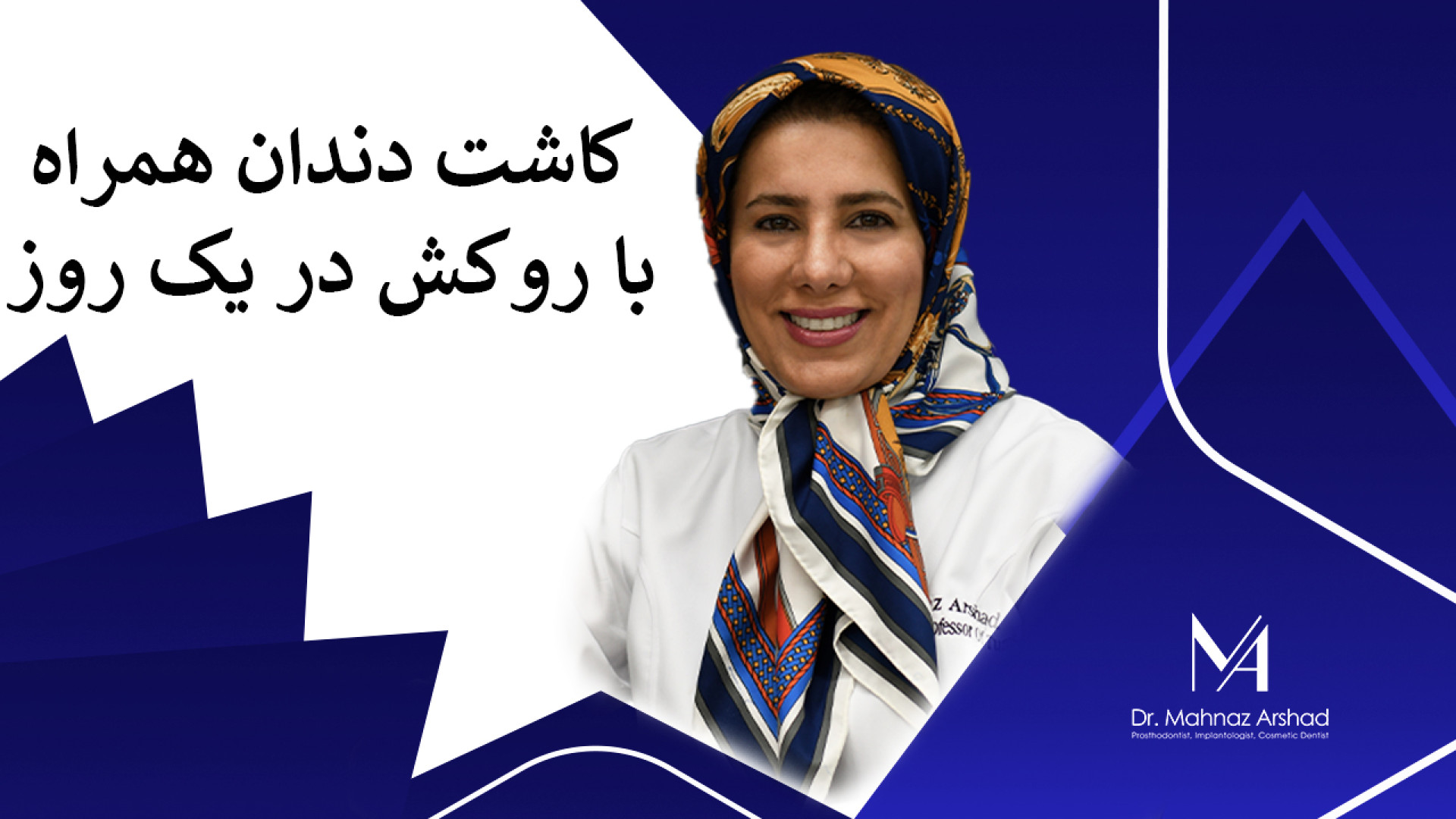 ایمپلنت همراه با روکش در ۱جلسه دکتر مهناز ارشد