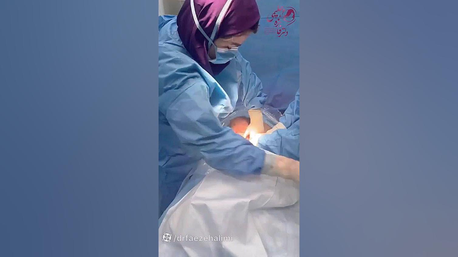 سزارین نوزاد دکتر فائزه حلیمی