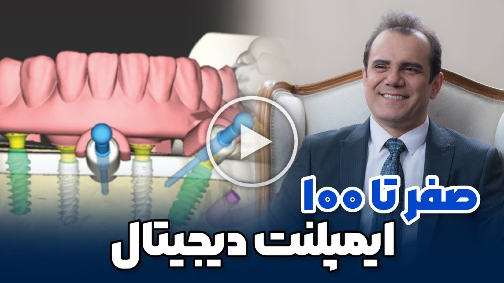 ایمپلنت دیجیتال دکتر عباس گشاده رو، متخصص جراحی لثه و ایمپلنت