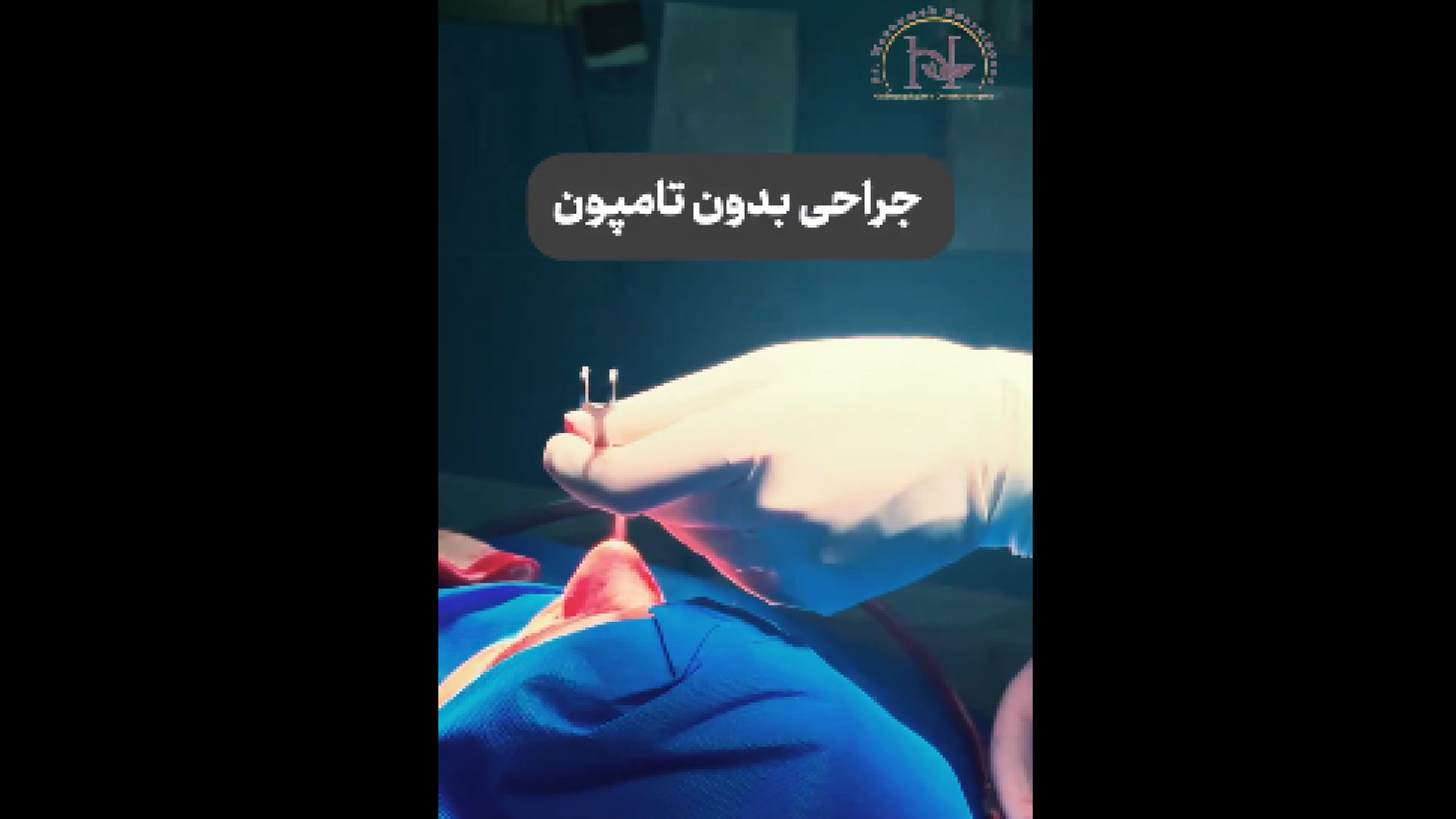 توضیحات خانم دکتر درباره جراحی بدون تامپون دکتر معصومه حسین پور