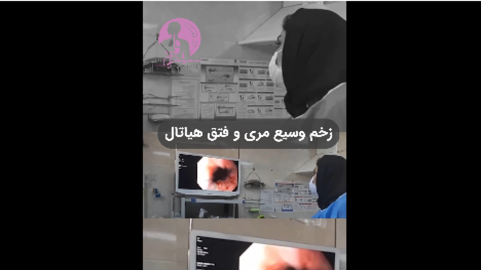 زخم مری و فتق هیاتال دکتر بیان شریفی-متخصص بیماری های داخلی