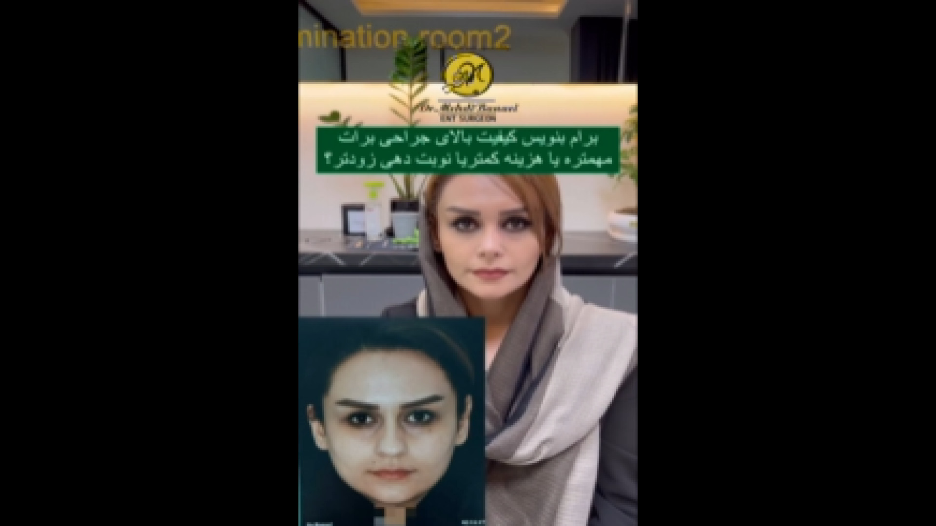 3.5 ماه بعد از عمل بینی