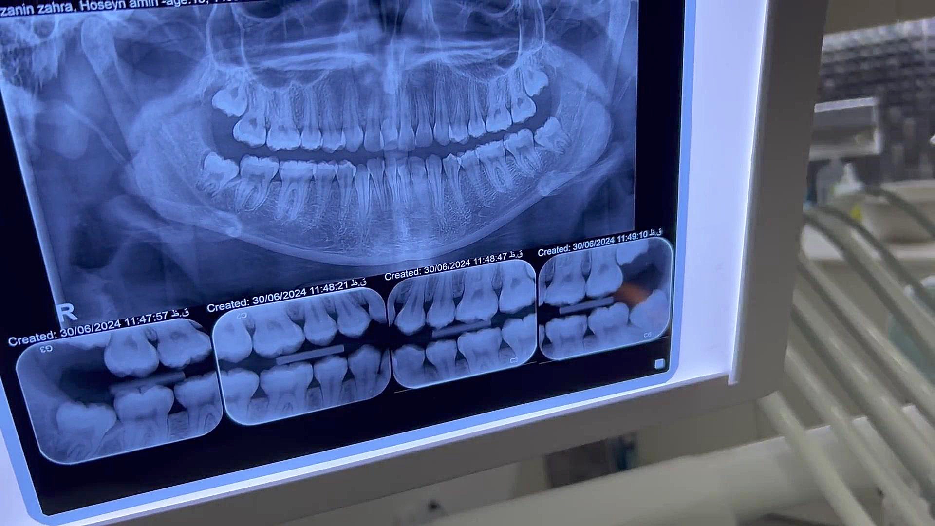 ارتودنسی دکتر فهیمی دكتر مهدي فهيمي هنزائي