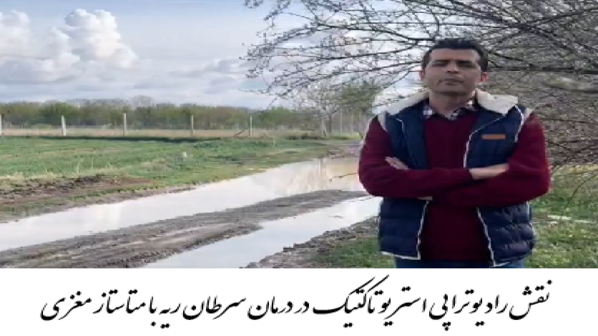درمان سرطان ریه با متاستاز مغزی توسط بهترین متخصص رادیوتراپی در تهران نیمار جونیور