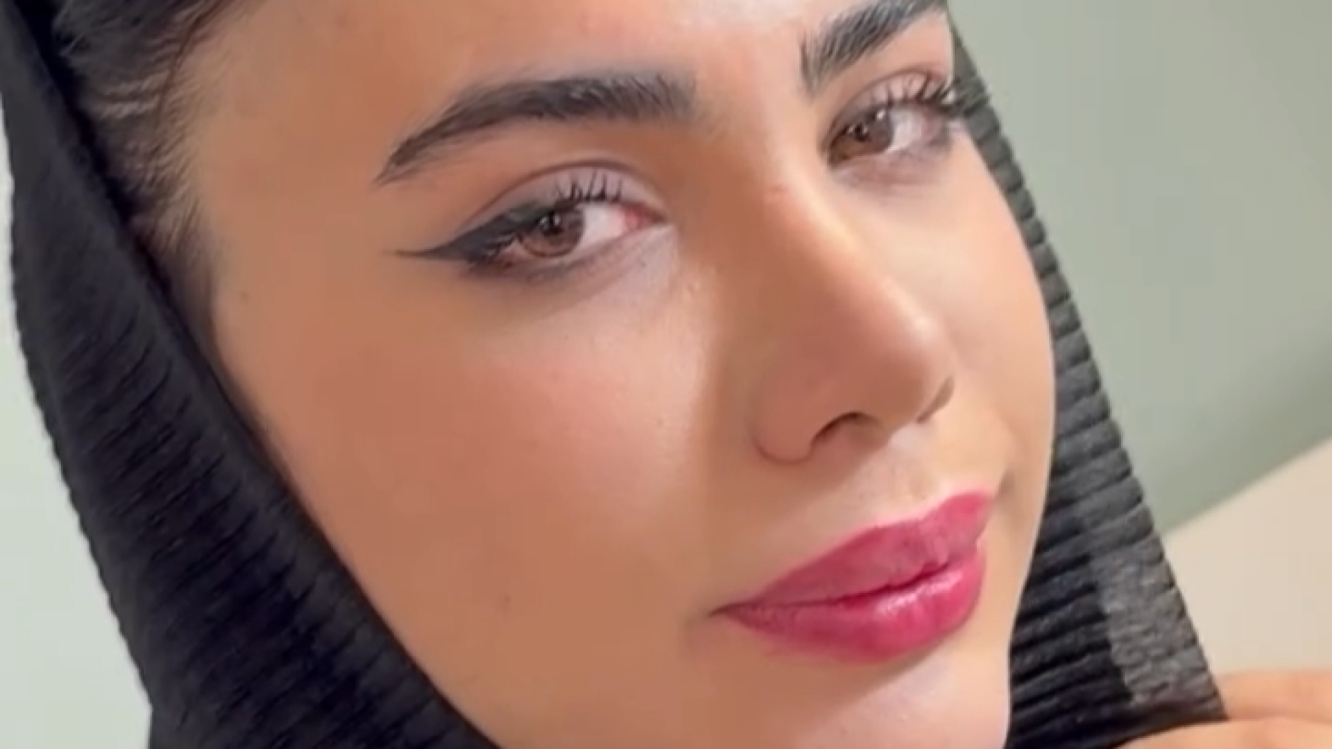 فقط ۶ماه از جراحی گذشته دکتر حمیدرضا مفرد