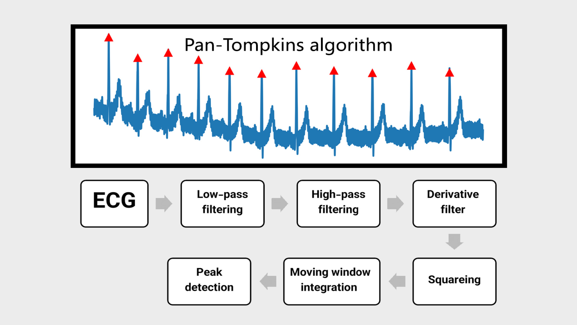 تشخیص پیکهای r در ecg با الگوریتم Pan-Tompkins پیلینگ شیمیایی