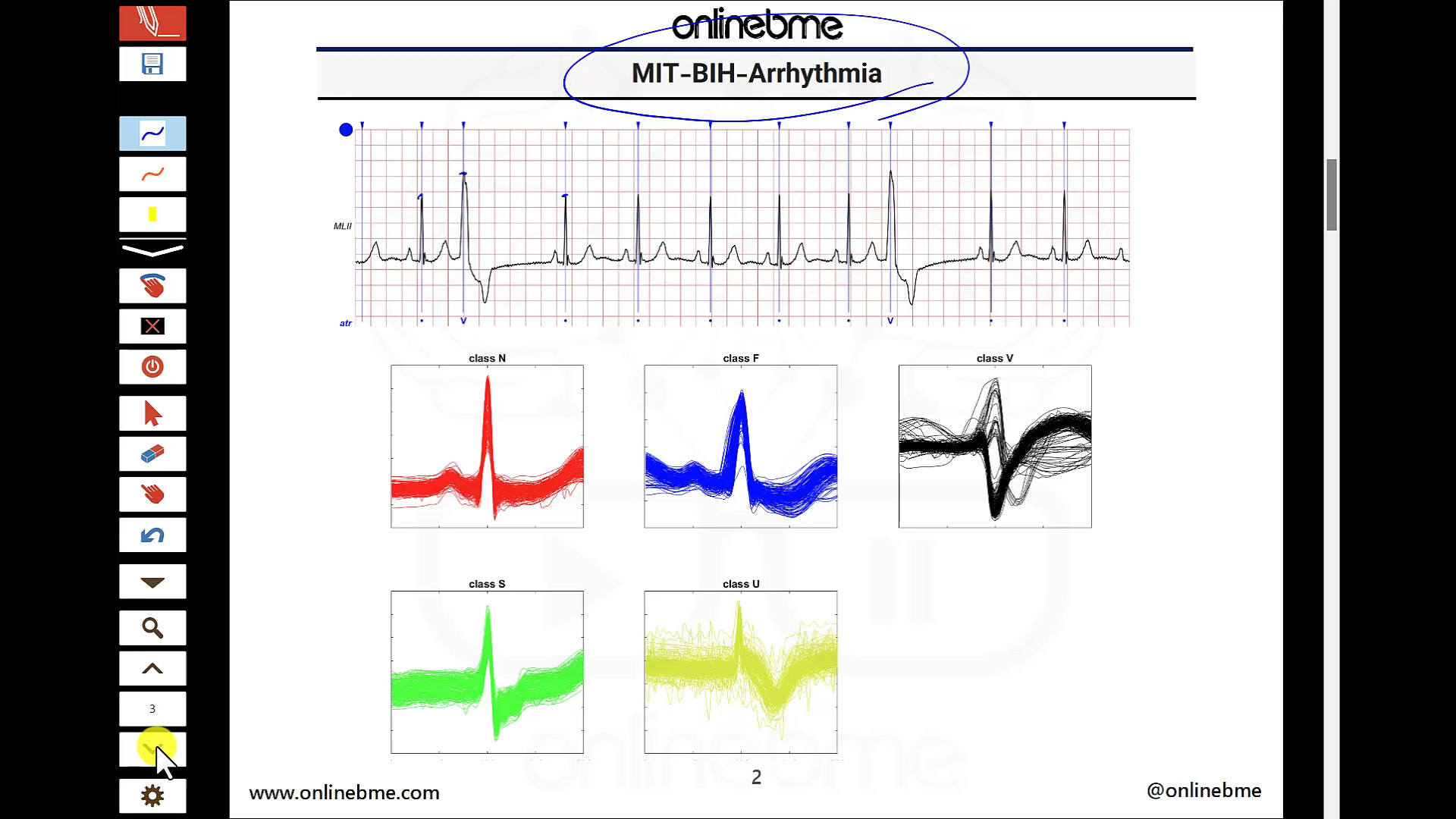 استخراج ویژگی از سیگنال ECG لمینت