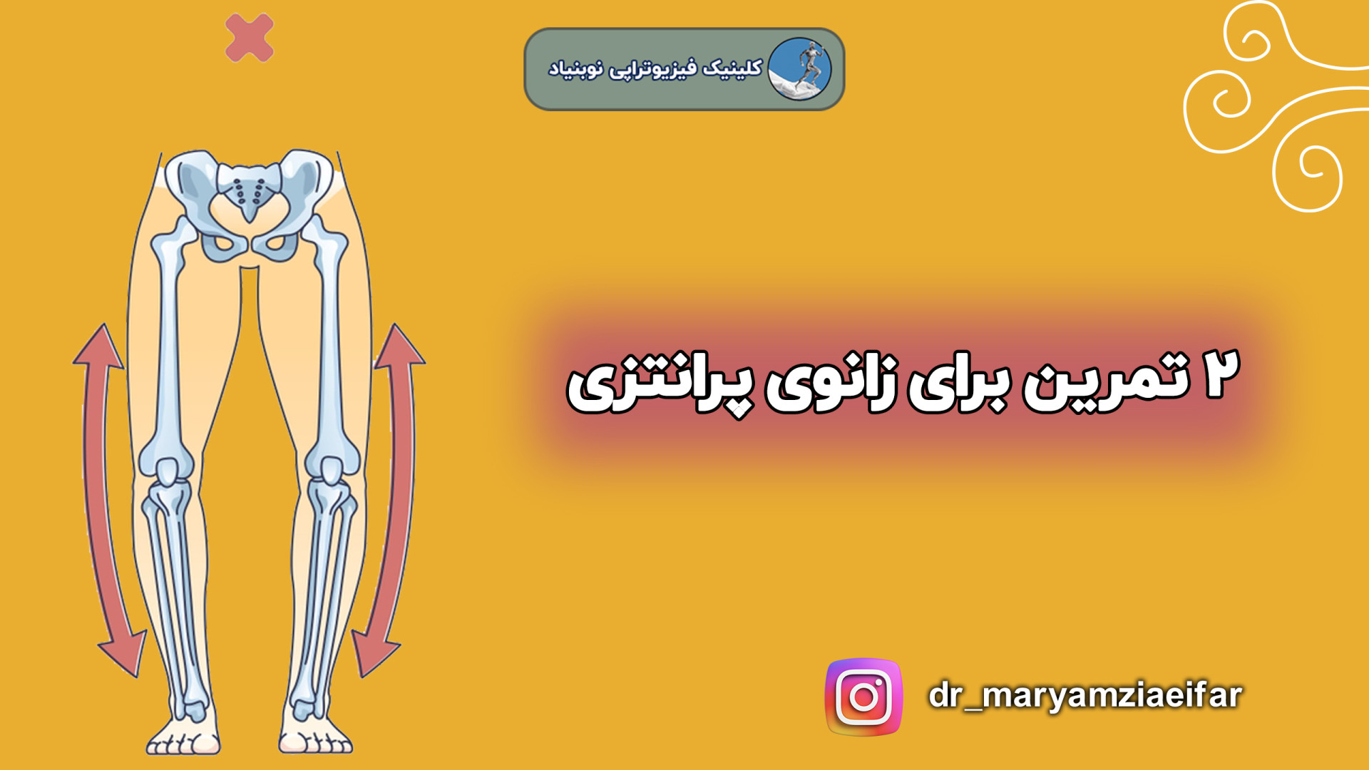 تمرین برای زانوی پرانتزی دکتر مریم ضیایی فر
