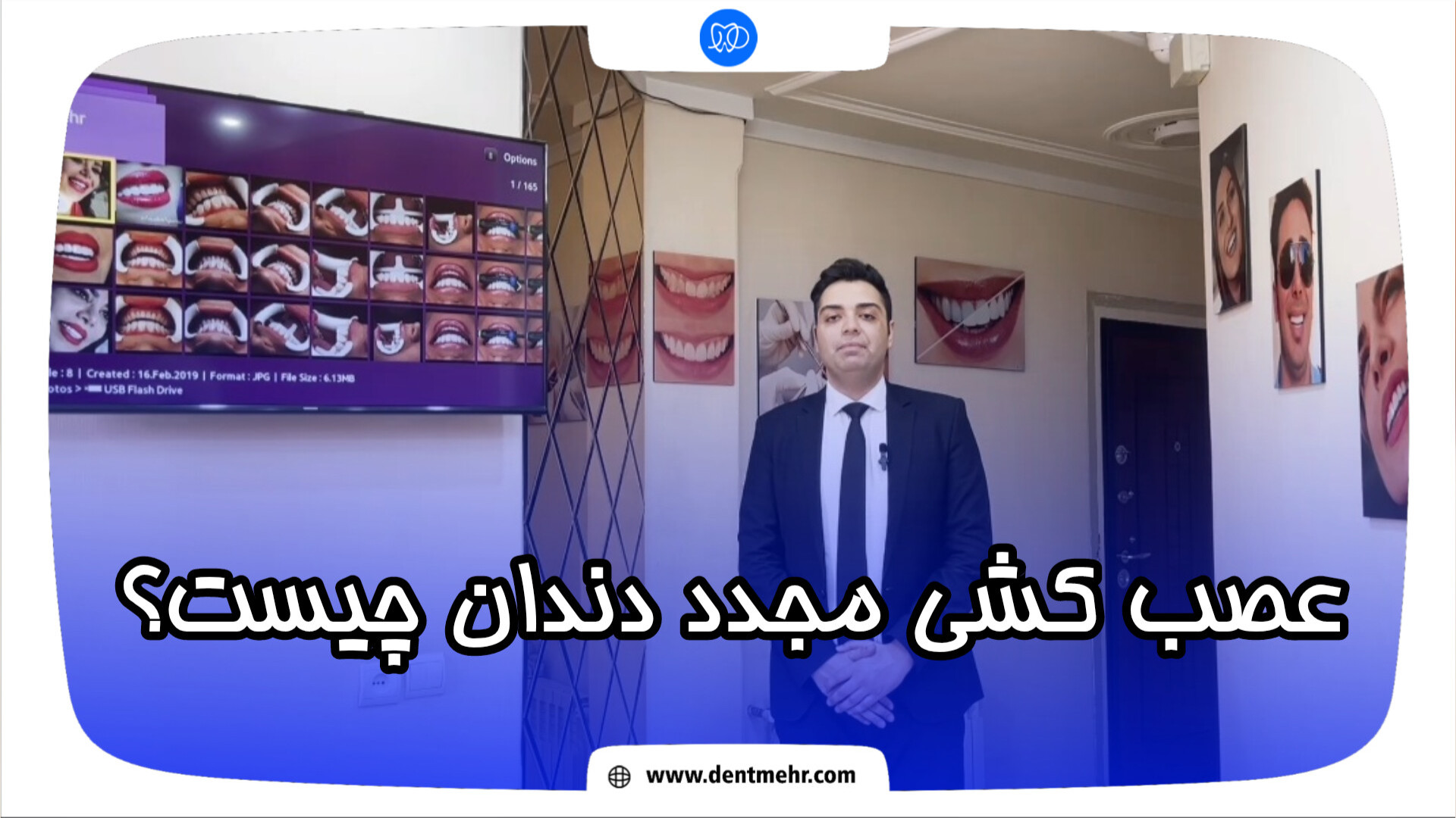 عصب کشی مجدد دندان چیست؟ اینسایزینگ
