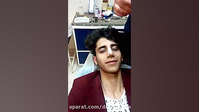نحوه چسب زدن بینی بعد از عمل جراحی ( دکتر حمیدرضا مفرد) دکتر حمیدرضا مفرد