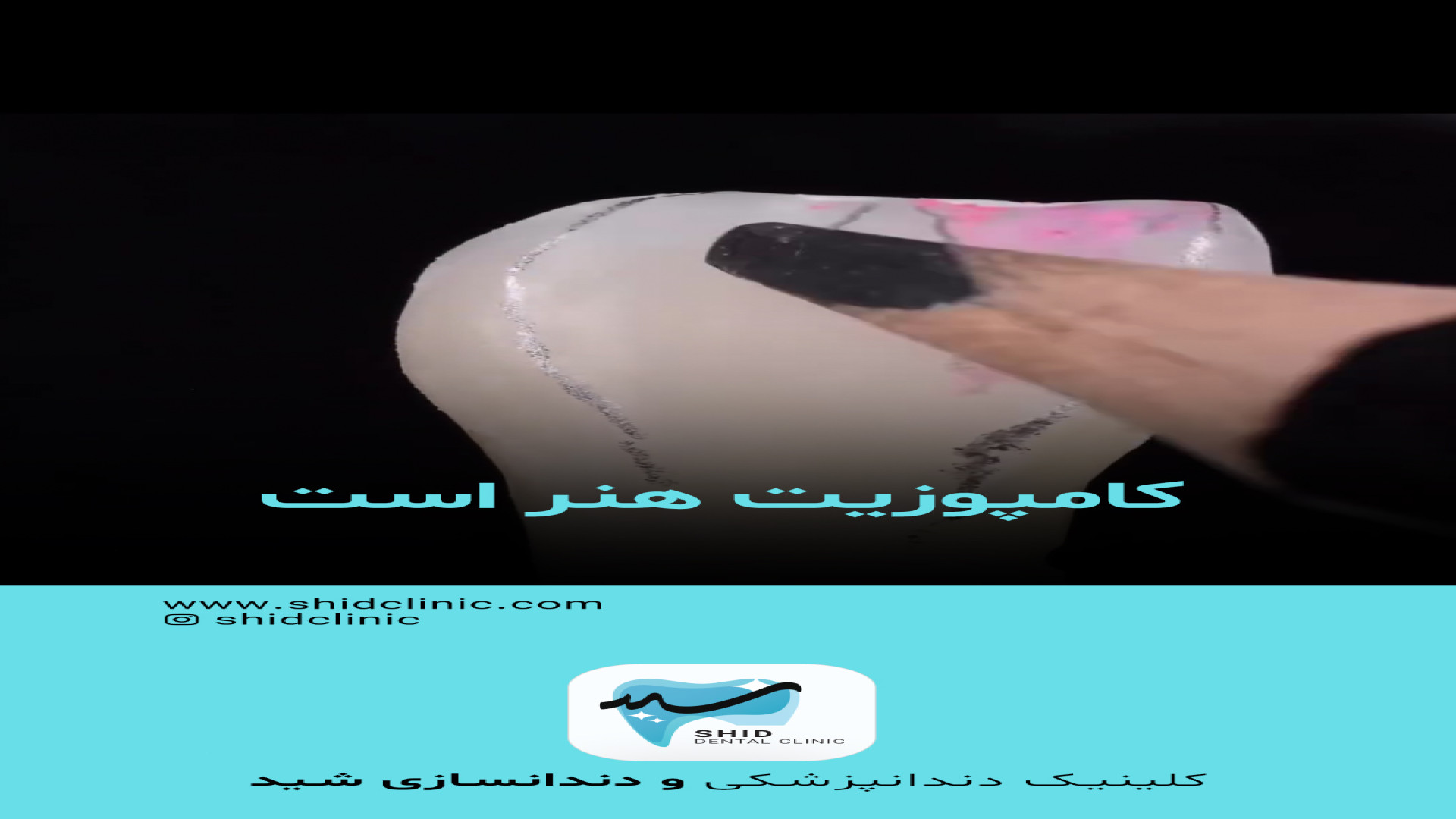 قیمت دندان مصنوعی فلکسی لثه نرم پلتفرم Drug Screening