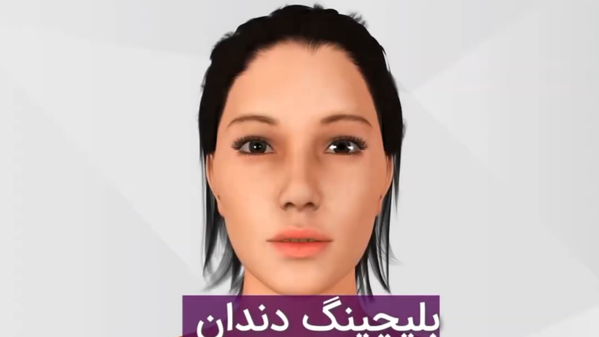 روش انجام بلیچینگ دندان دکتر امین جباری