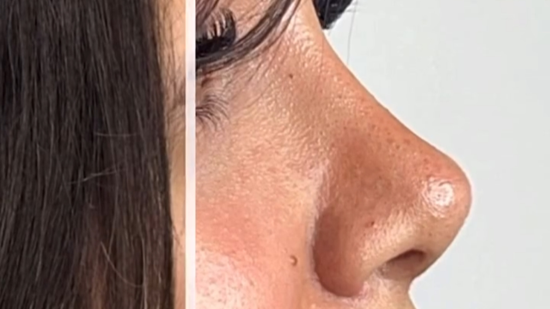 جراحی بینی یعنی این که با یه تغییر کوچیک توی صورتت، حس و حال جدیدی به زندگیت بدی دکتر حمیدرضا مفرد