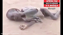 مرگ کودکان در سومالی