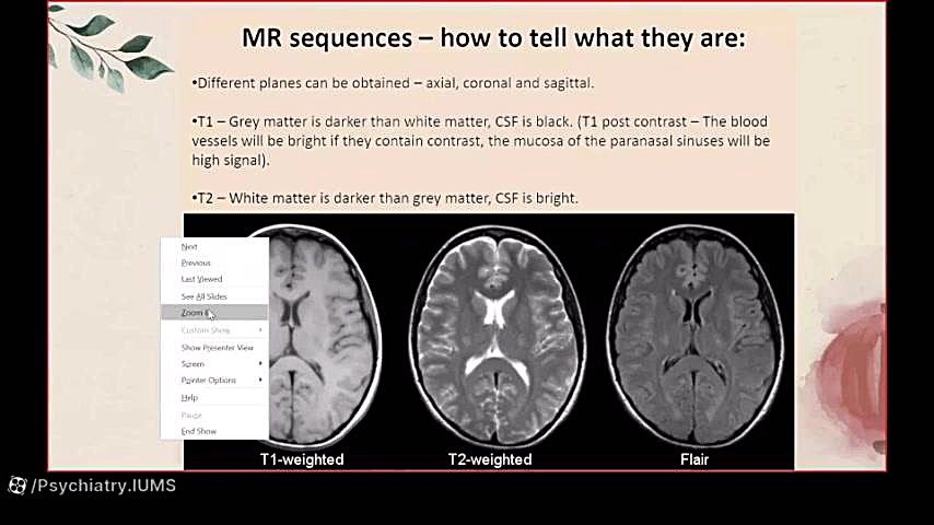 تصویربرداری مغزی(Brain CT-scan and MRI)- دکتر لیلا کمال زاده درمان جای جوش