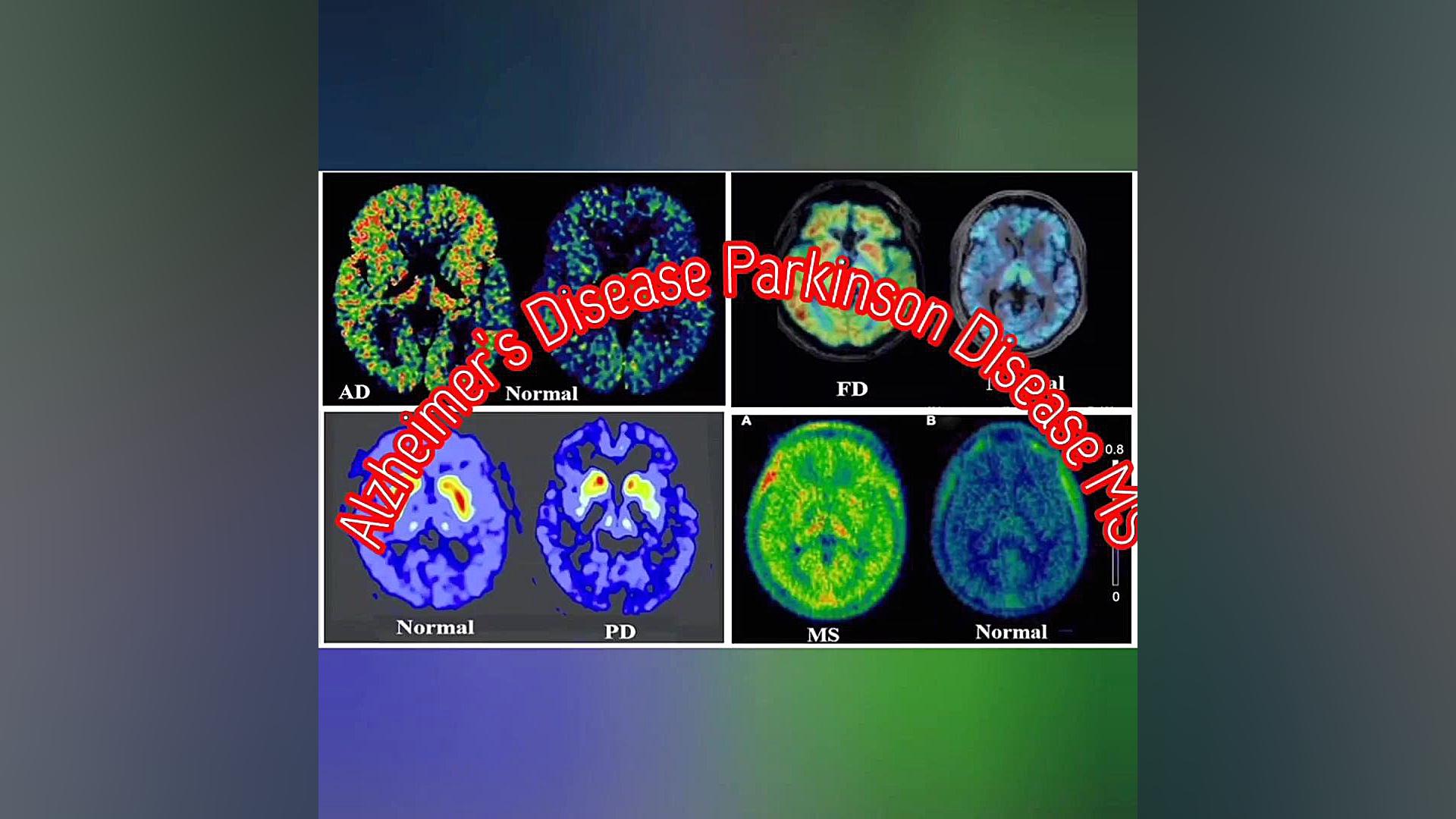 تصویربرداری بر مبنای عملکرد ارگانها ( PET _CTscan) مجله آنکولوژی ( دکتر رضا )خدابخشی