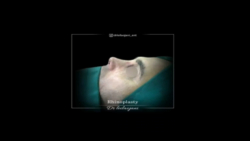 truncate dir-rtl