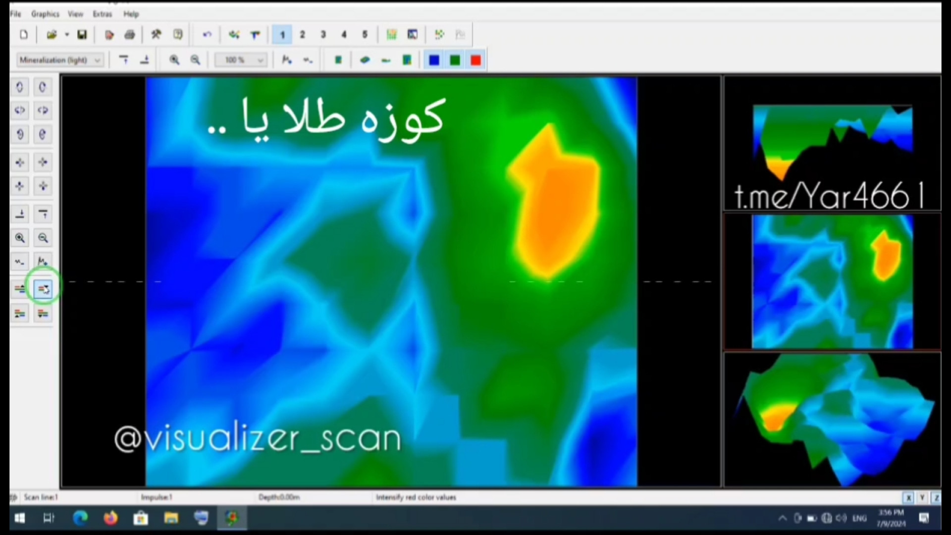 کوزه طلا در اسکن یا ..در ویژولایزر کلینیک زیبایی
