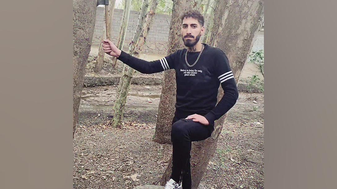 جواد صمیمی مشهد دروی تزریق بوتاکس