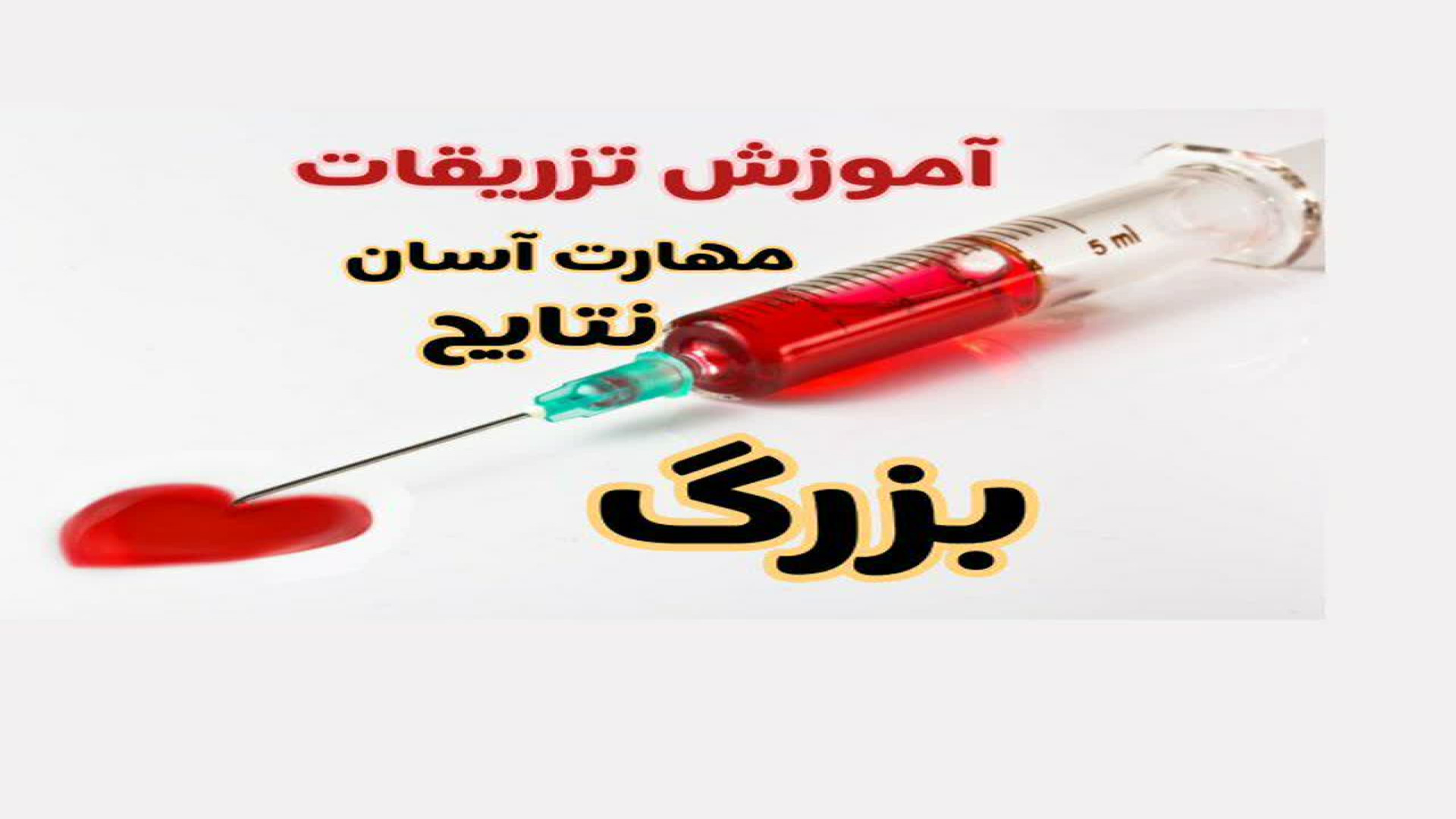 آزمایش خون ویدیو سوم لخته، قند خون ناشتا و چک عملکرد کلیه لیفت ابرو