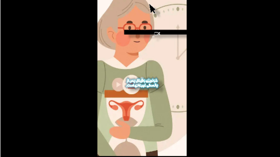 درمان آندومتریوز