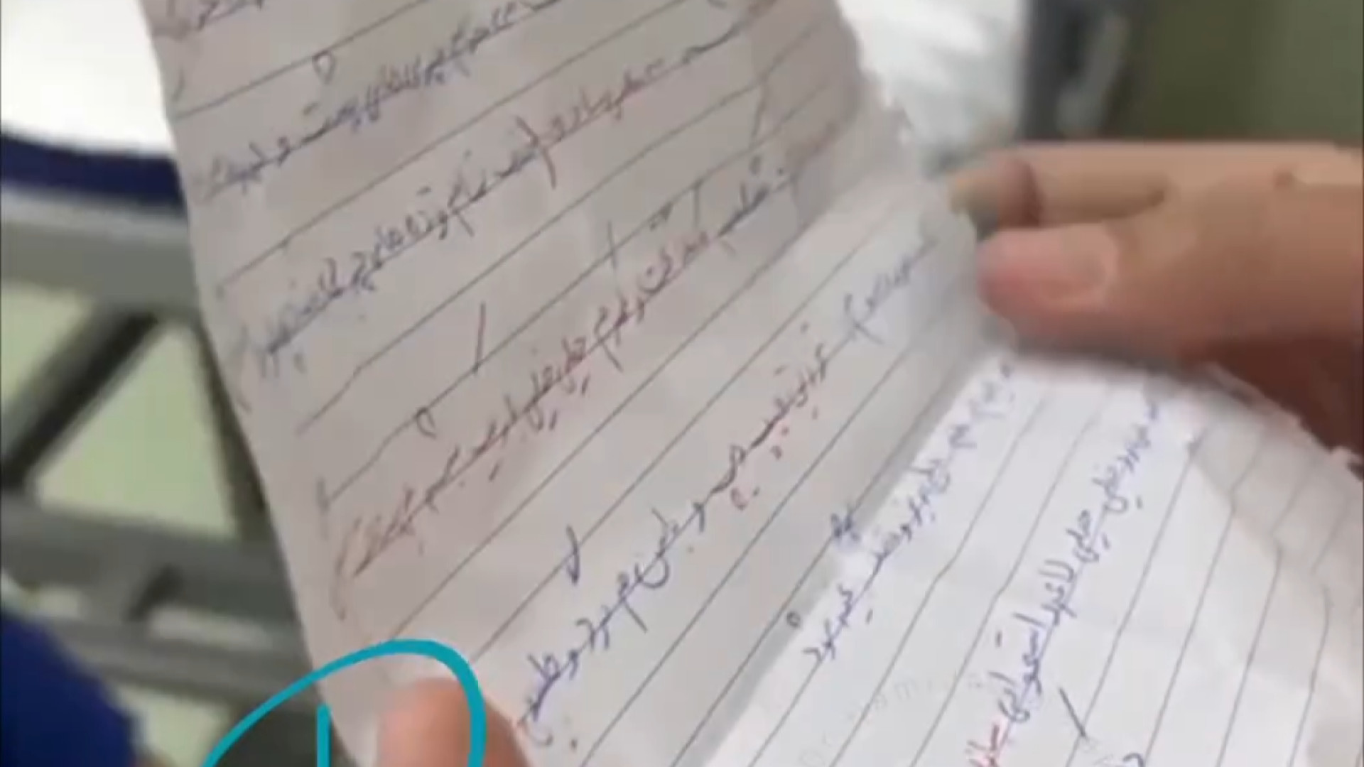 نامه جالب مریض به جراح زیبایی - لیپوماتیک اوتیلومیومبر