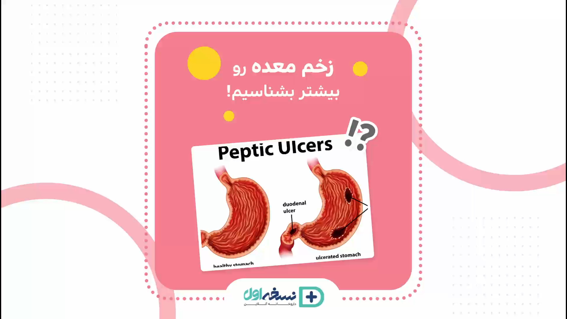زخم معده - داروخانه آنلاین نسخه اول - داروخانه اینترنتی نسخه اول ترمیم سوختگی