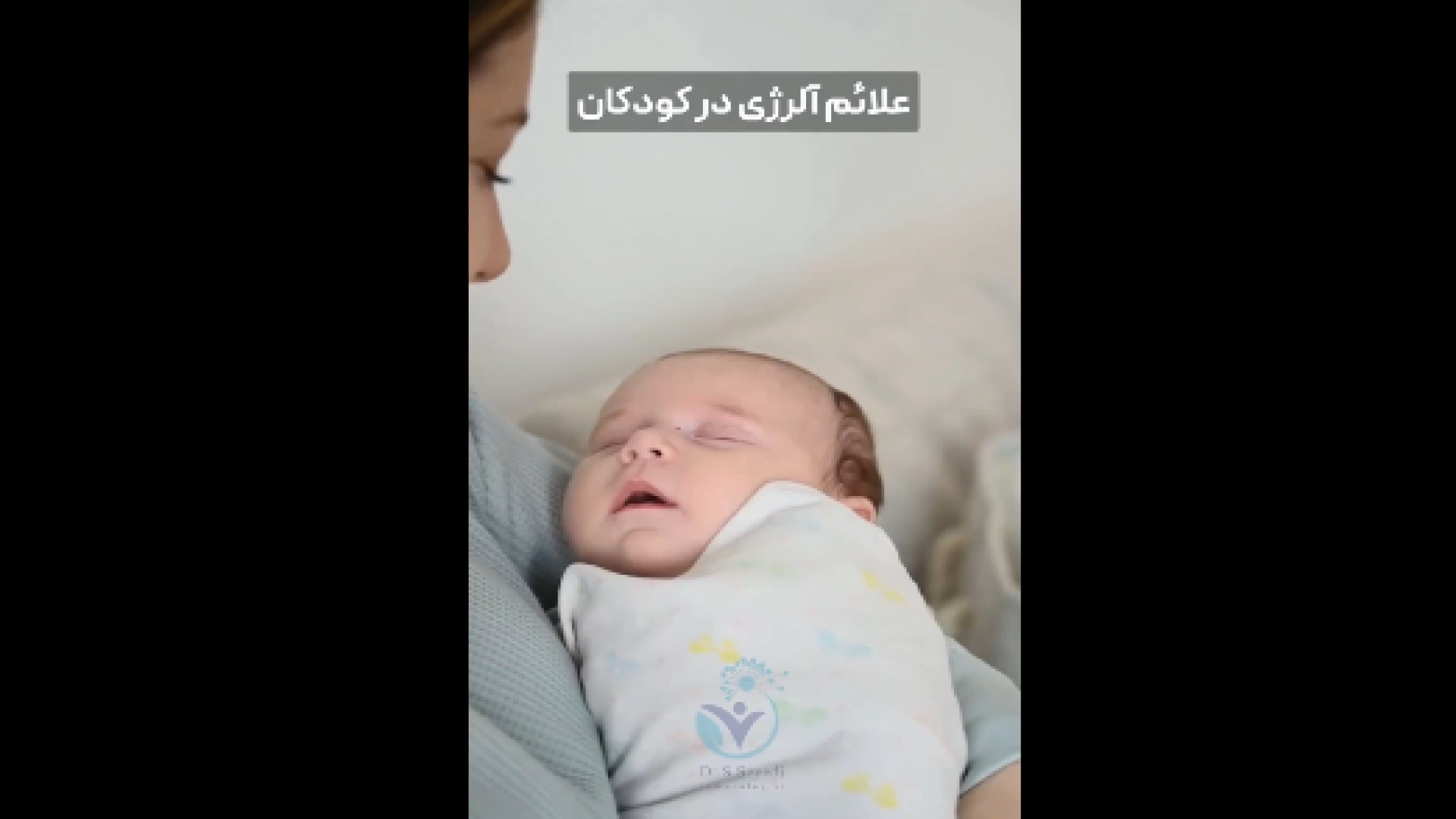 علائم آلرژی در کودکان پاکسازی پوست