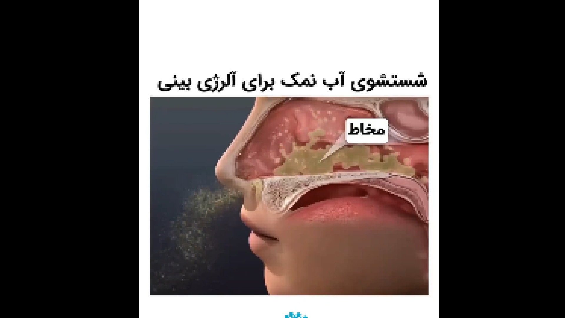 شستشو با آب نمک برای آلرژی بینی دکتر شهرام سیدی متخصص آلرژی و ایمونولوژی