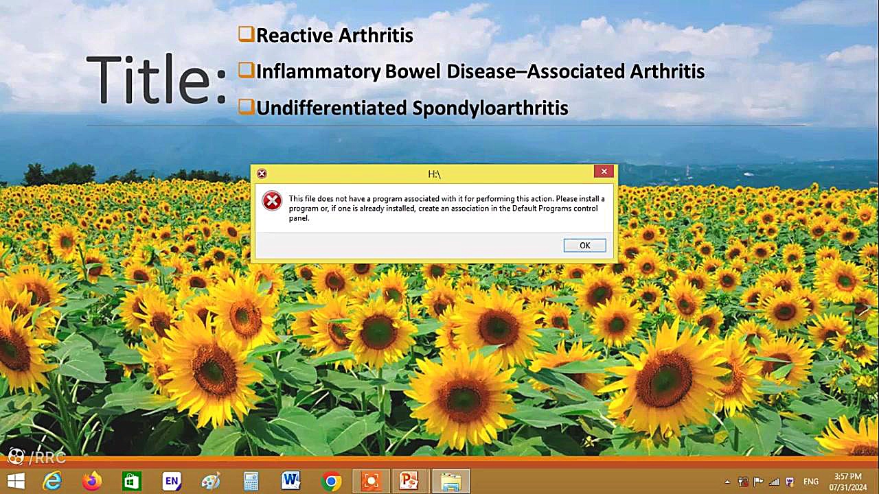 Reactive Arthritis کشیدن دندان