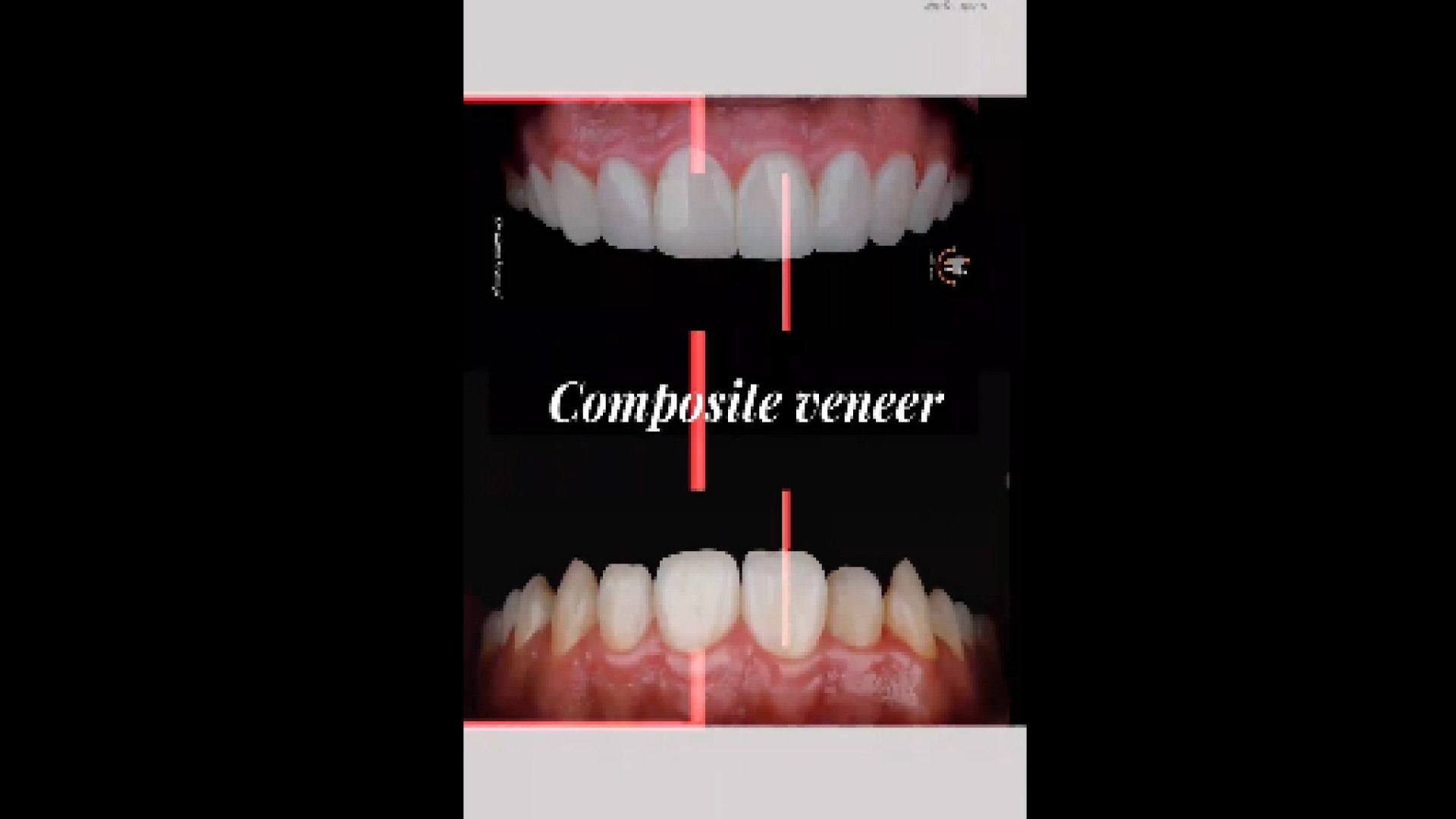 نمونه کار دکتر برنگی دکتر سیمین برنگی | Dr Simin Berangi