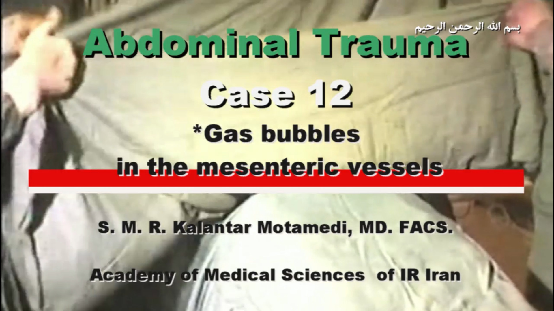 Abdominal trauma-Case12-gas bubbles in the mesenteric vessels پوشش زخم هیدروکلوییدی