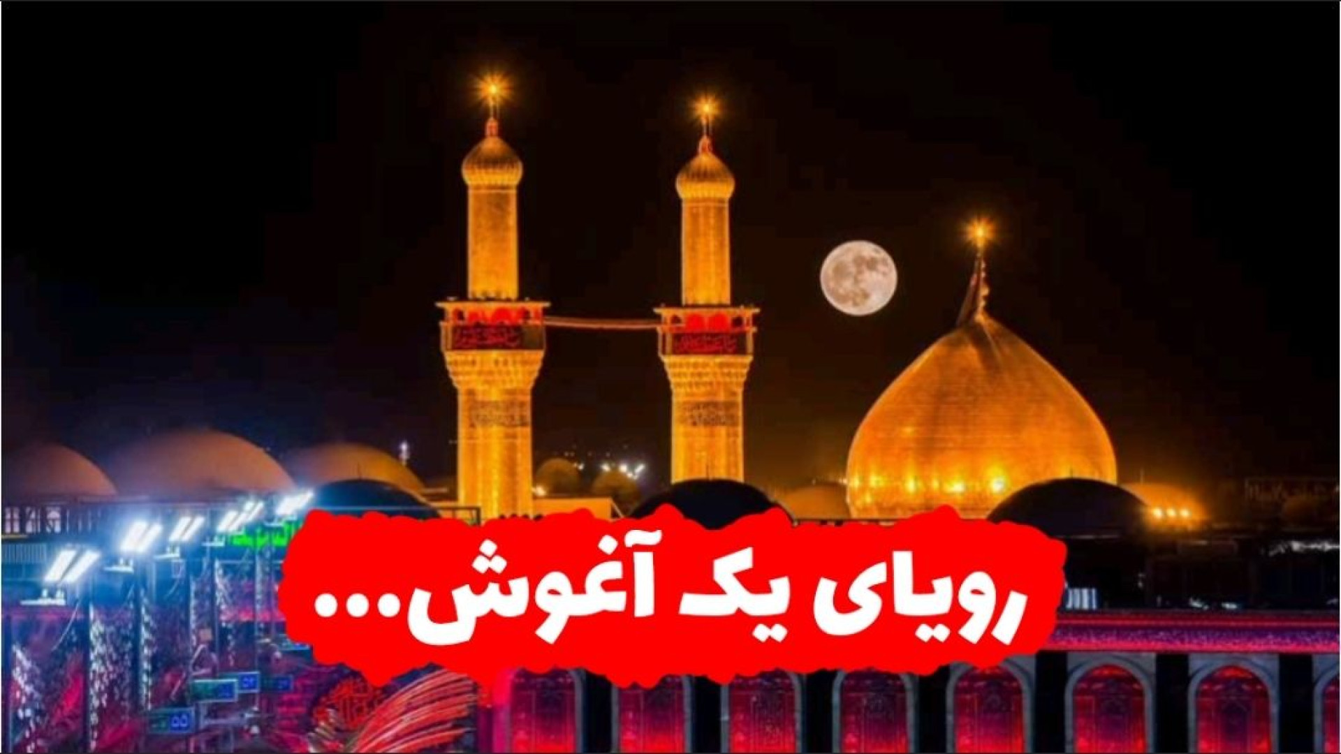 بوسه بر شش گوشه اباعبدالله ( اربعین ) ترمیم دندان