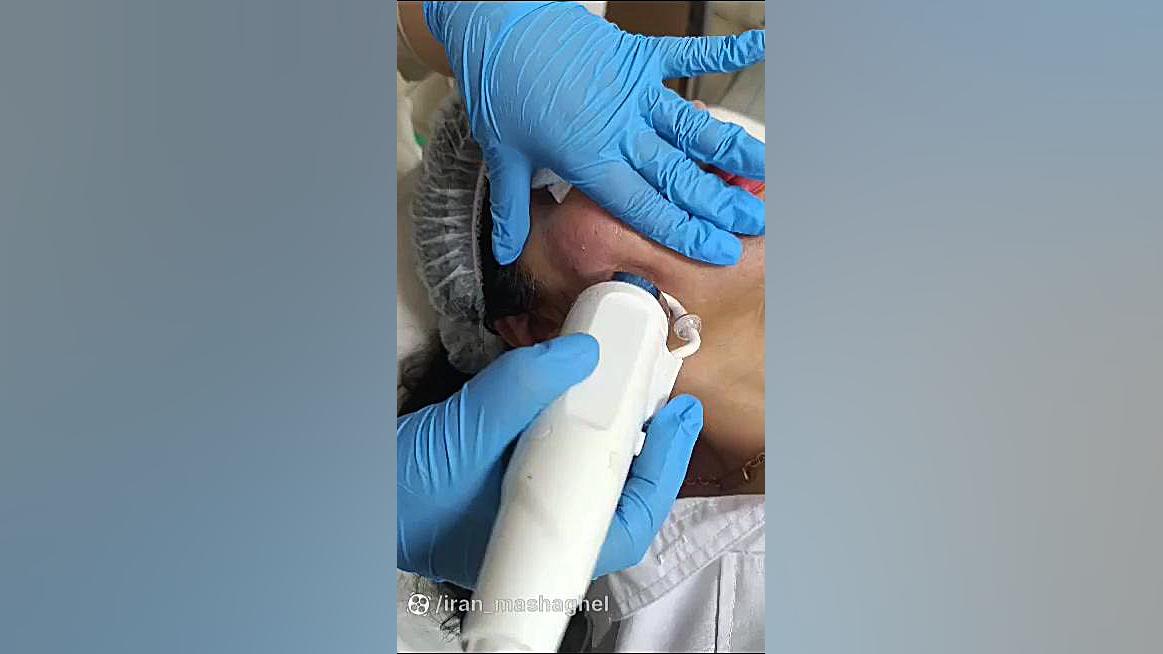 خدمات زیبایی و فیشیال پوست سحر چناری در معالی آباد شیراز دندان مصنوعی