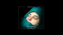 truncate dir-rtl