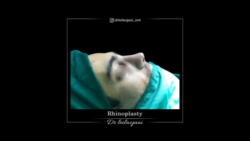 truncate dir-rtl