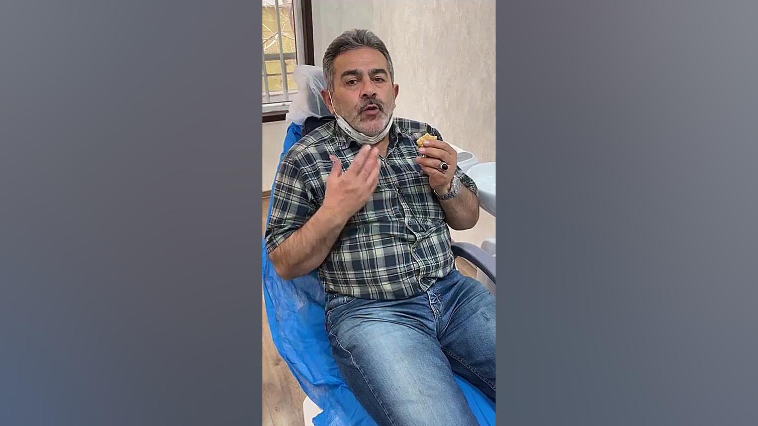 تجربه گذاشتن دندان مصنوعی برداشتن زگیل