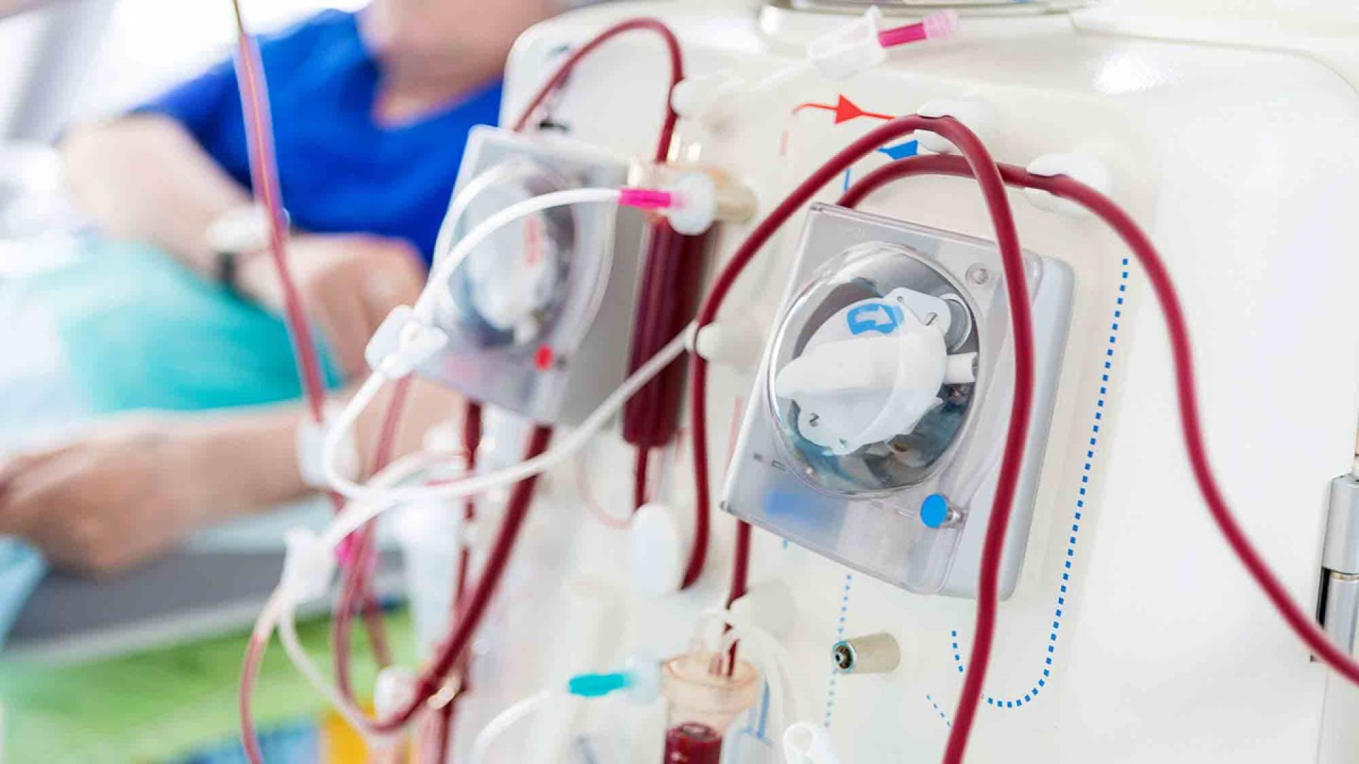 درمان دیالیز با آب عکاسی خیابانی