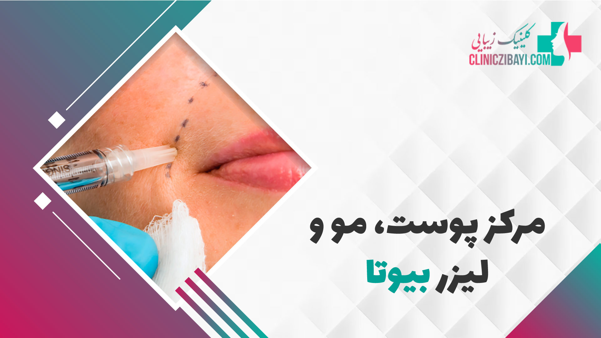 مرکز پوست، مو و لیزر بیوتا - کلینیک زیبایی ارنیزوماب