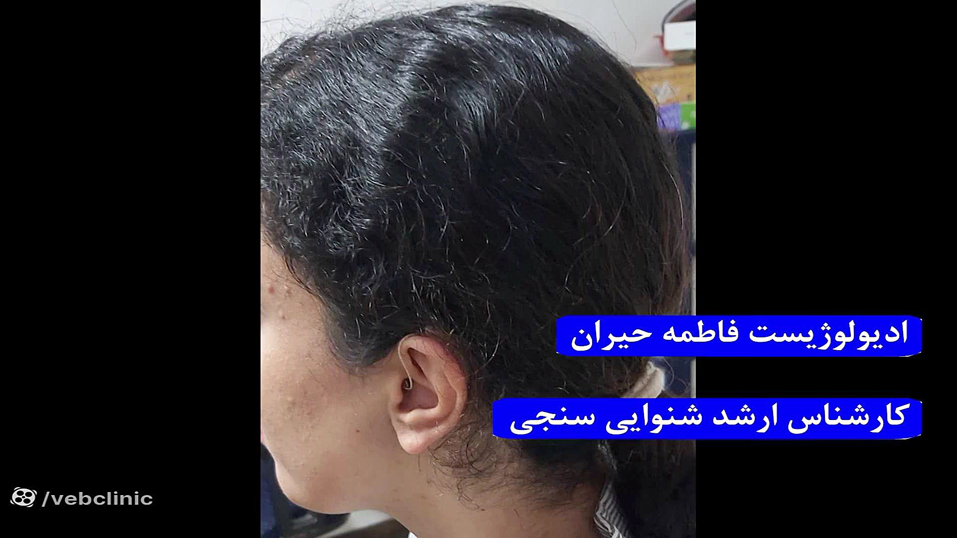 شنوایی سنجی شیراز برداشتن توده