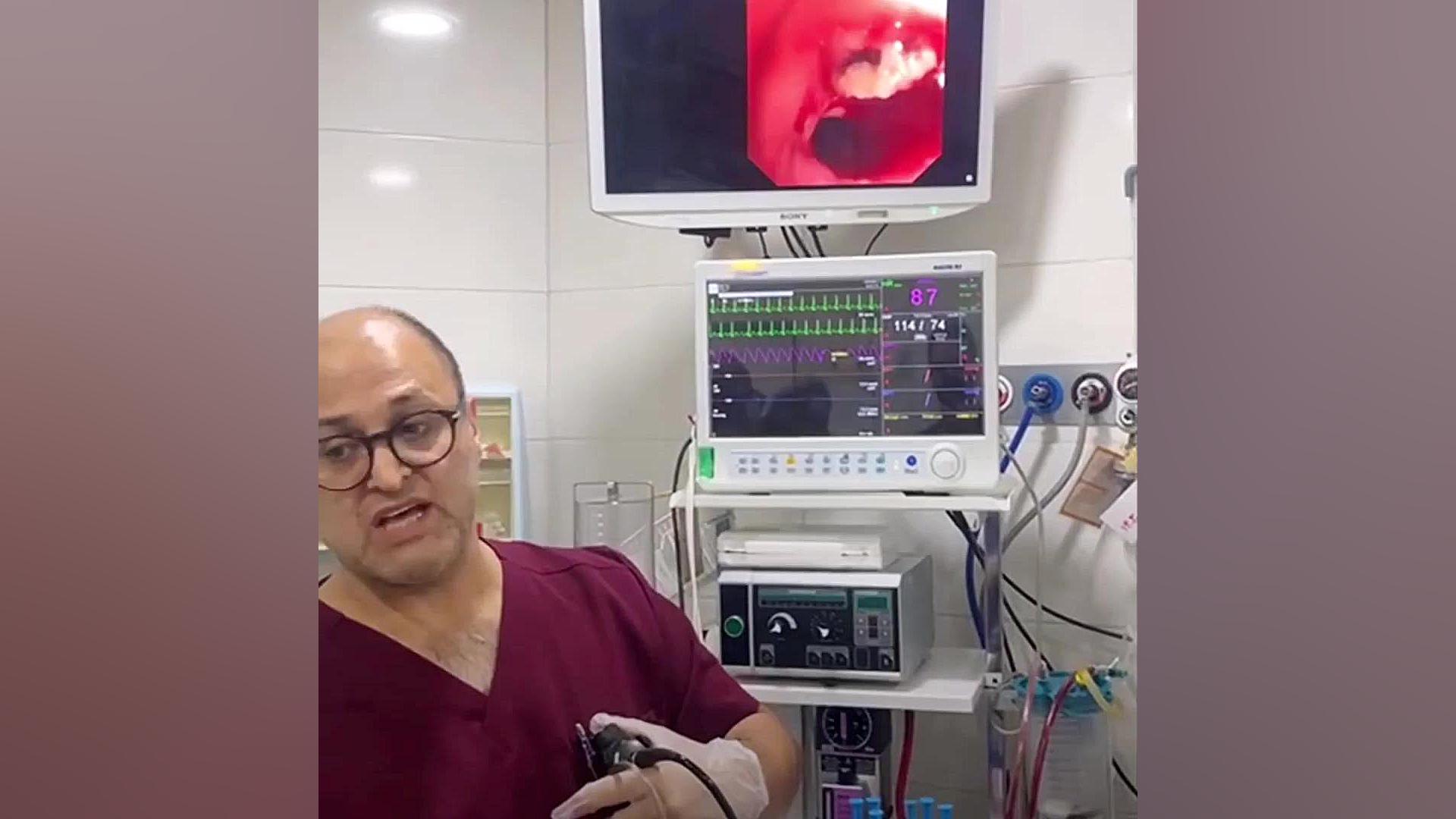 سه بار عفونت ریوی به دلیل وجود تخمه در ریه پای پتی