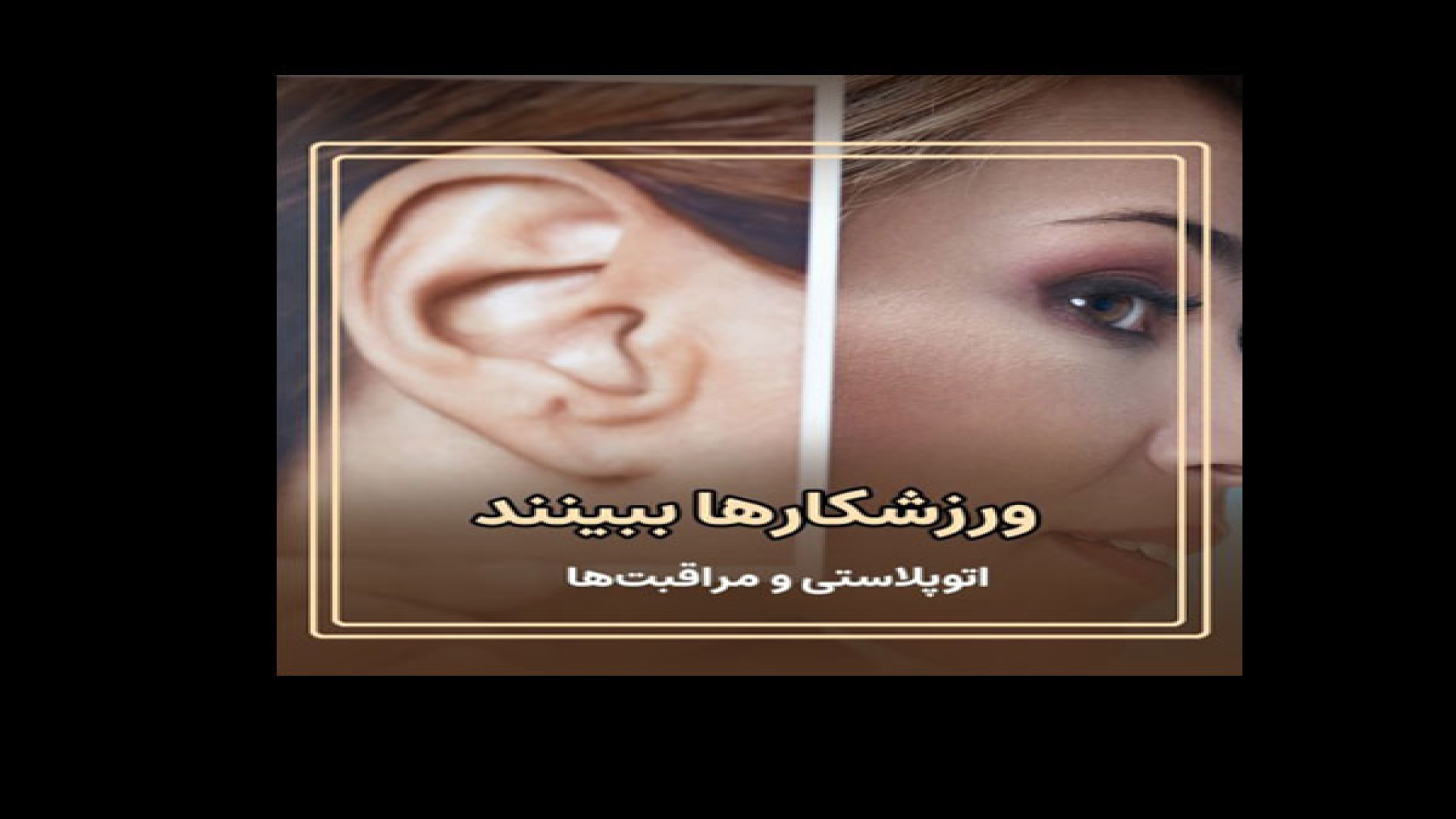 شروع مجدد ورزش بعد از جراحی گوش | دکتر راضیه یابری برداشتن زگیل
