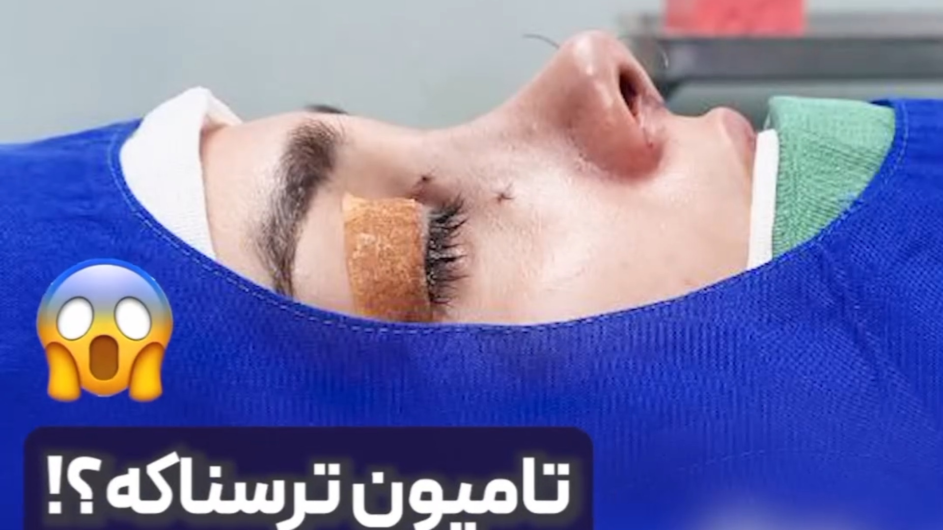 گذاشتن تامپون توسط دکتر علی حسینی واجاری دکتر علی حسینی واجاری - جراح بینی رشت