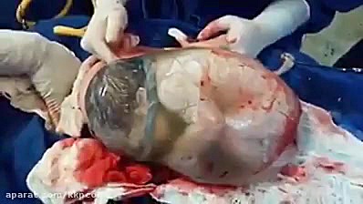 نوزاد تازه متولد شده بازی موبایل