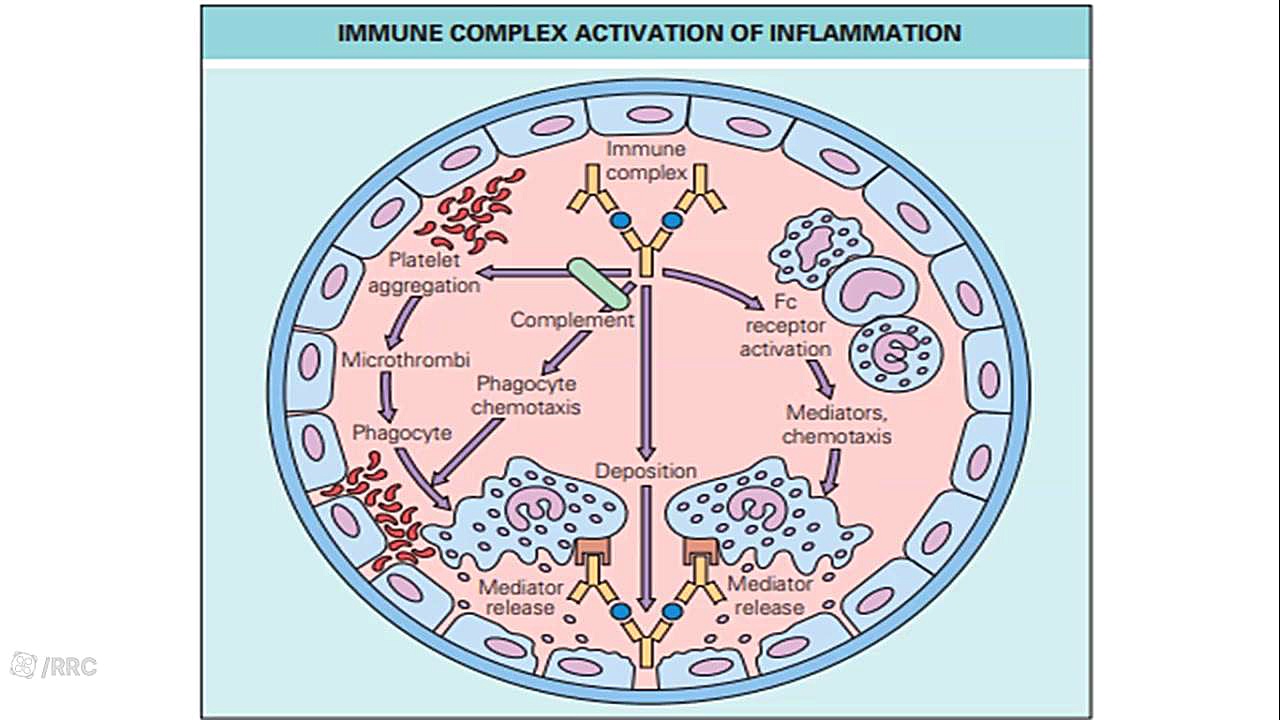SLE PATHOGENESIS اتوپلاستی