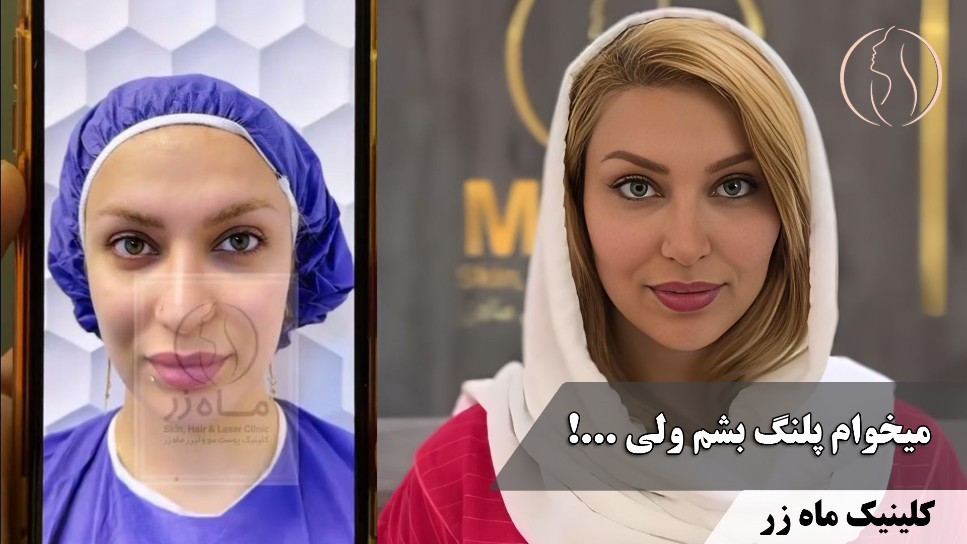 تجربه سفر در زمان با مامان !!! ( کلینیک زیبایی ماه زر ) Organoid Viability Test