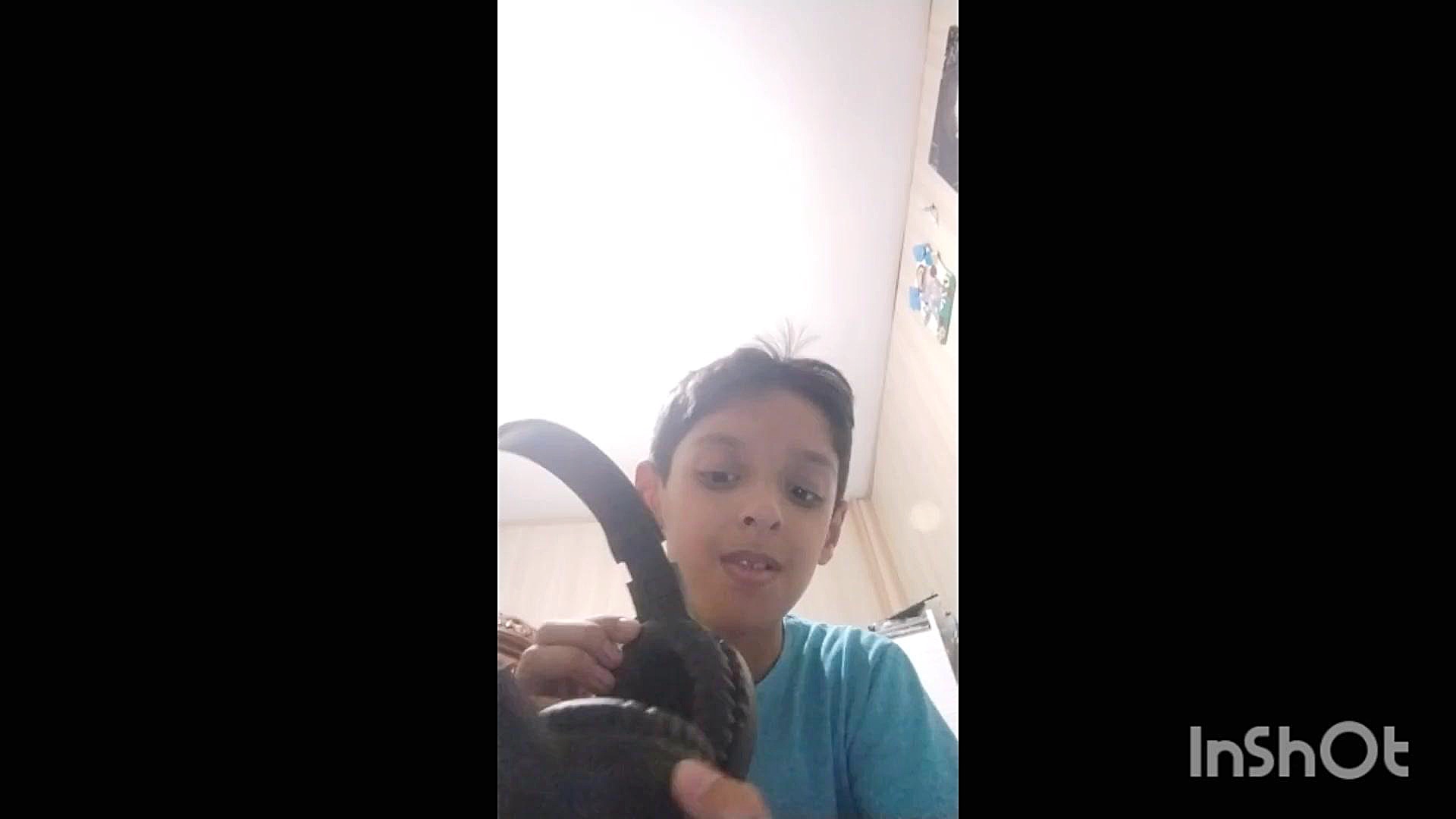 انباکس وسایل های گیمینگ درمان جای جوش