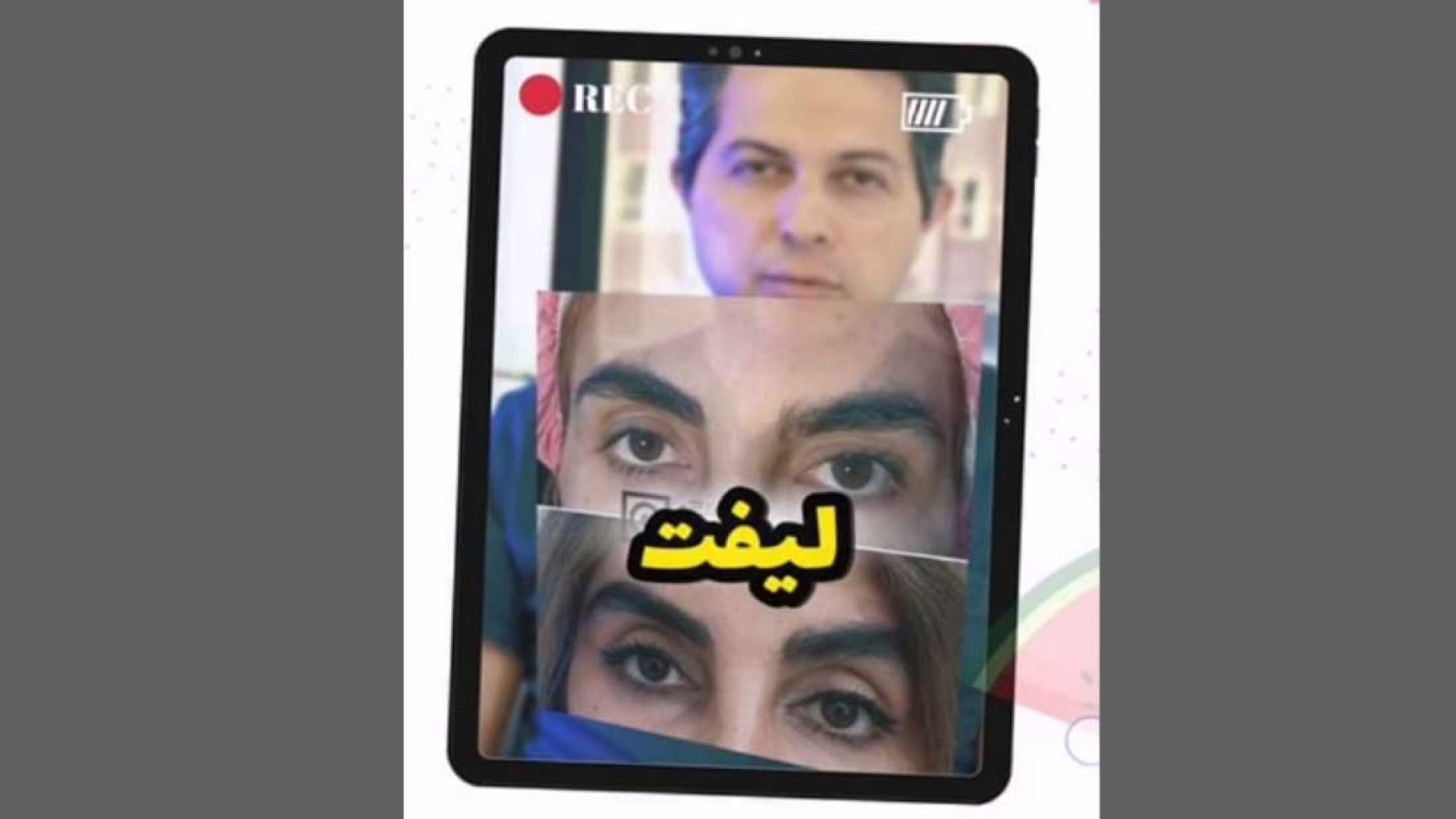 لیفت ابرو یا شقیقه V/Q Scan