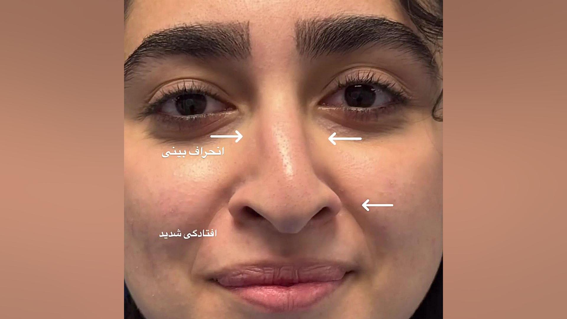 جراحی زیبایی توسط دکتر مفرد دکتر حمیدرضا مفرد